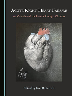 cover image of Acute Right Heart Failure: An Overview of the Heart's Prodigal Chamber